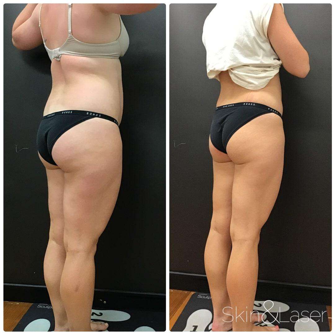 Before & Afters