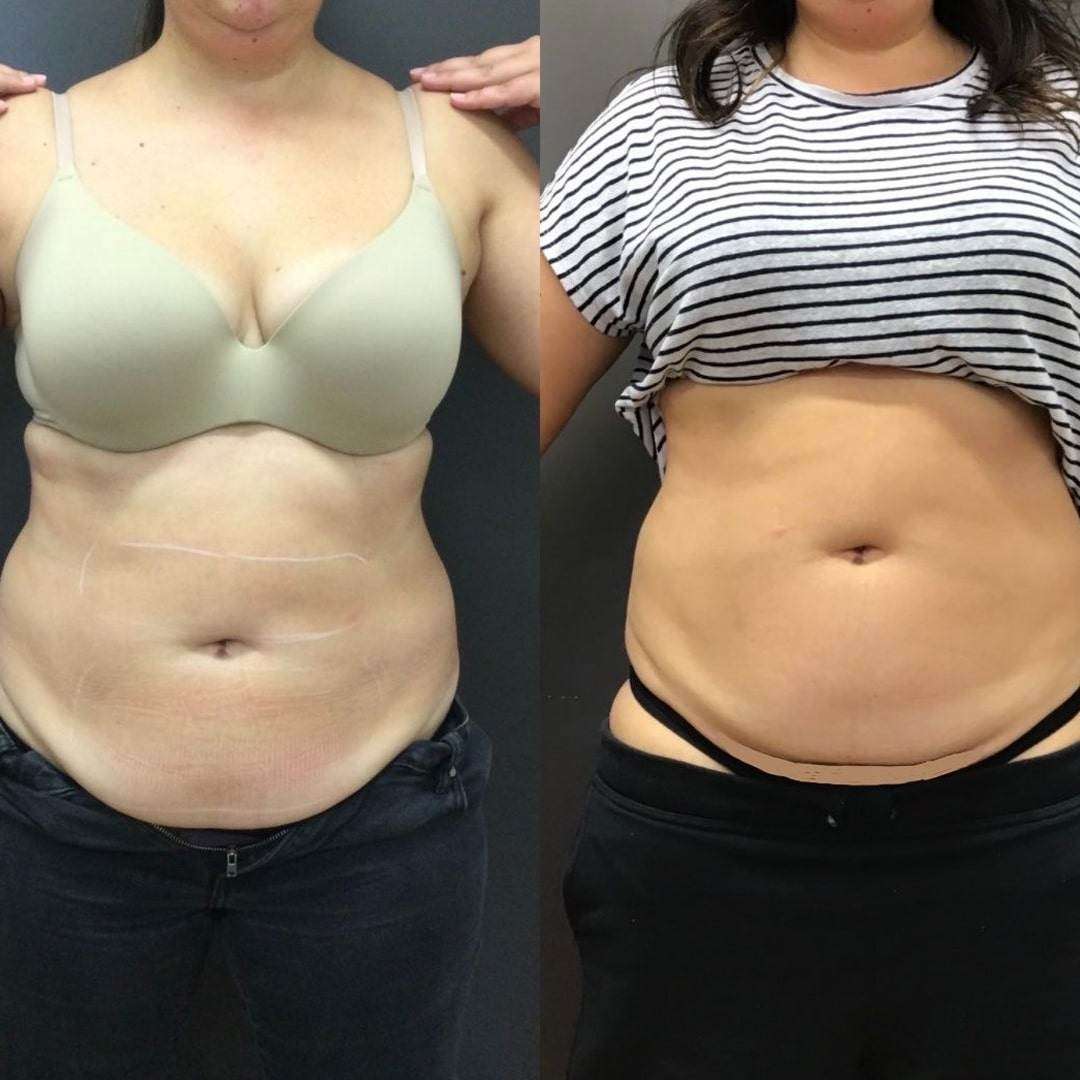 Before & Afters