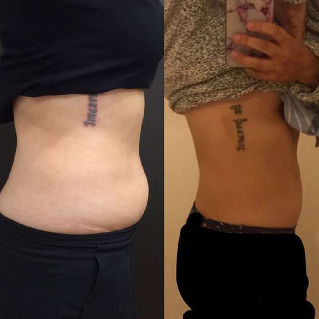 Before & Afters