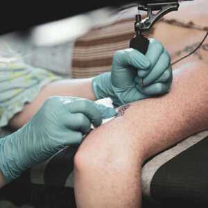 richmond skinnlaser