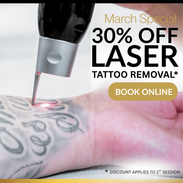 laser tattoo removal specials