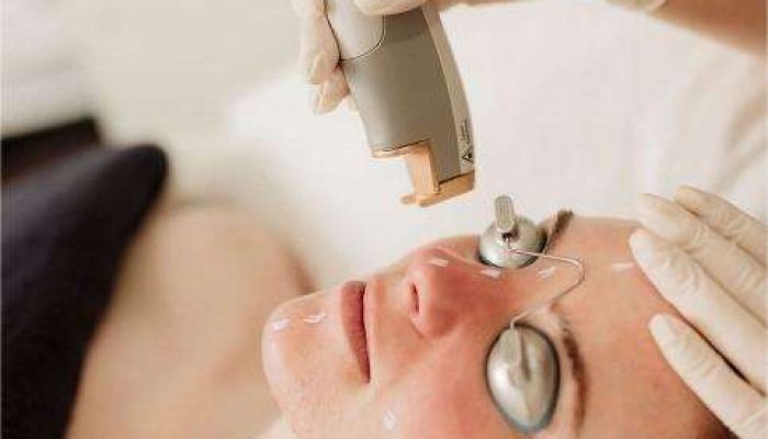 Let’s talk about Laser Genesis
