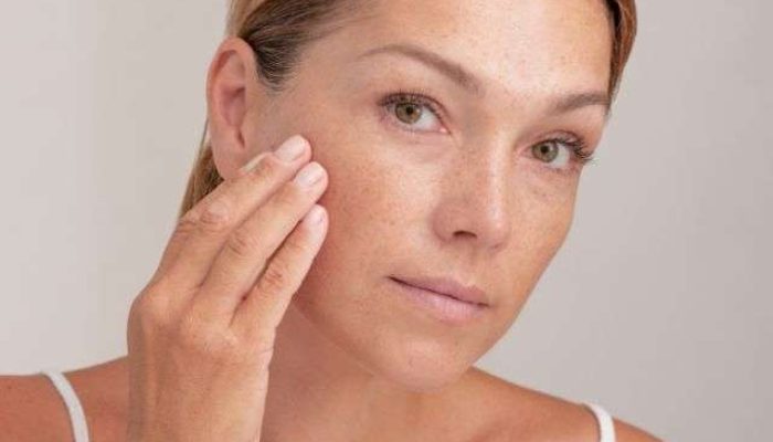 Pigmentation (2)
